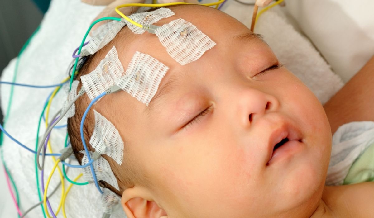 Pediatric Stroke: What Every Parent Should Know