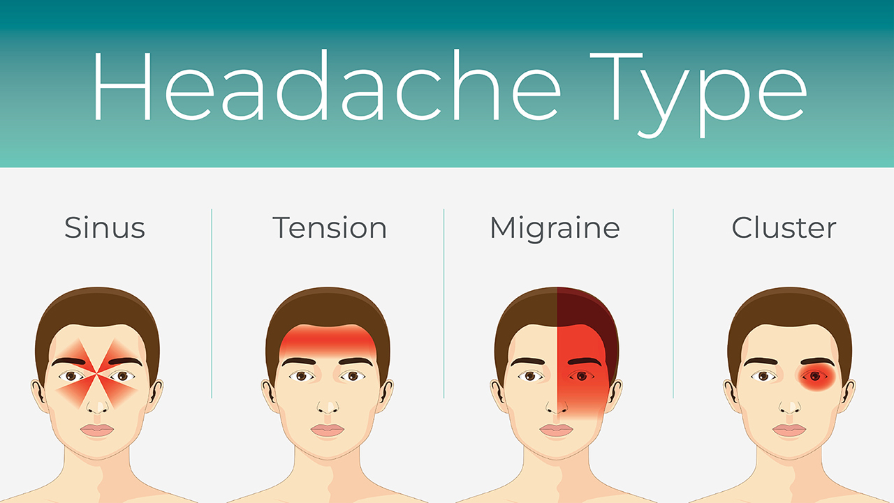 Understanding the Different Types of Headaches and How to Manage Them