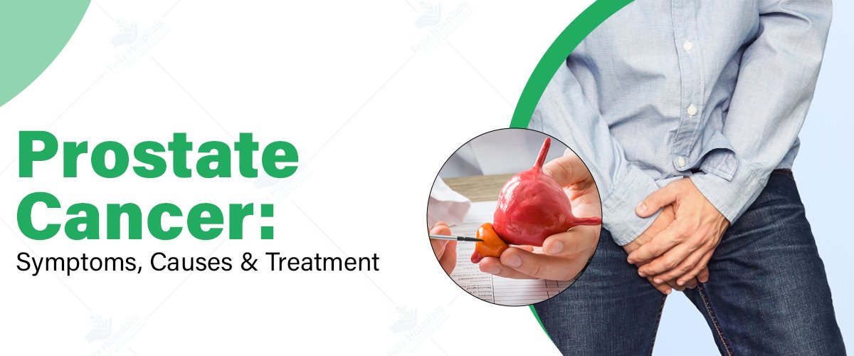 Prostate Cancer Treatment Cost:A Complete Guide to Your Options
